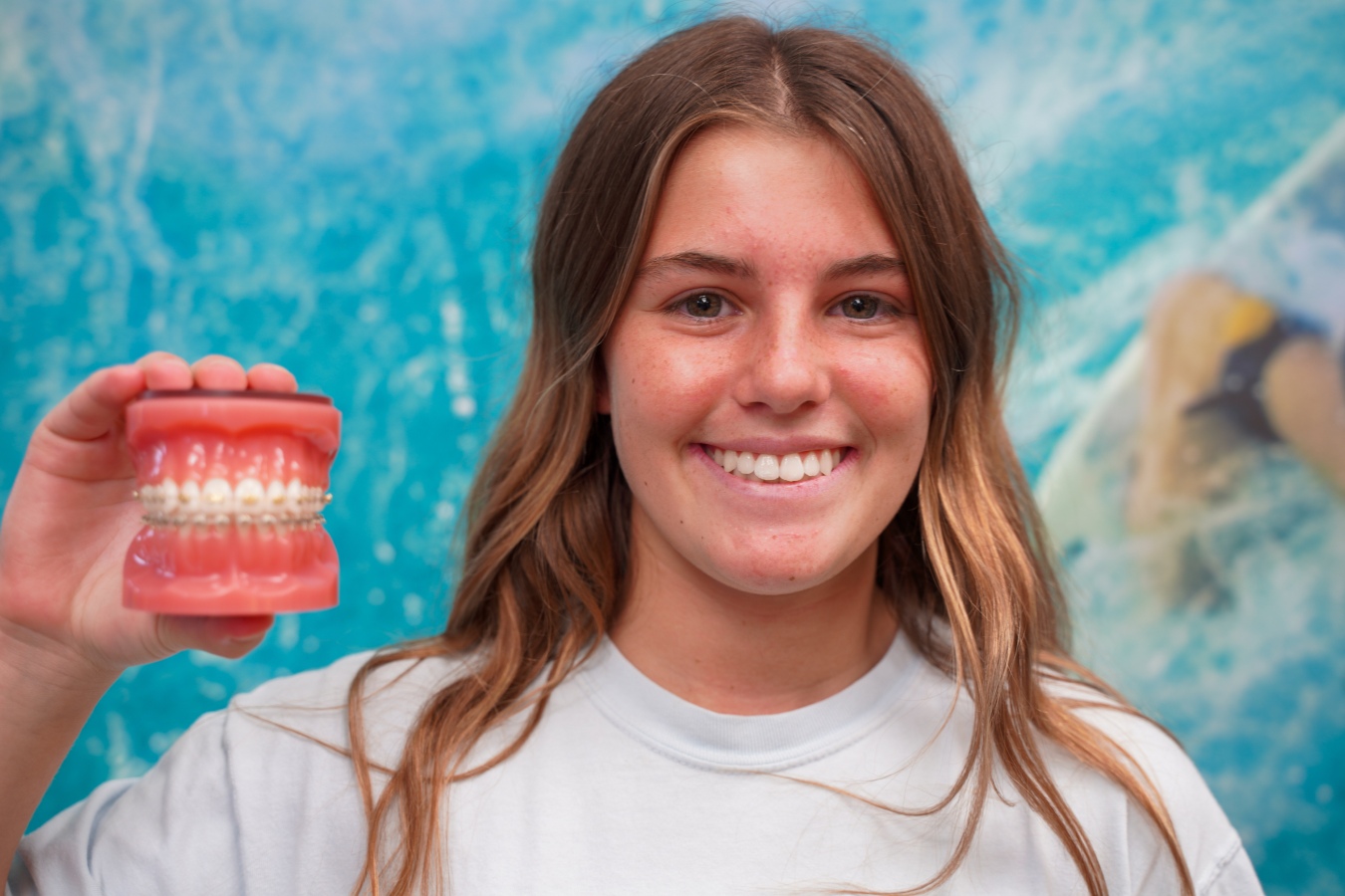 Braces for Teens